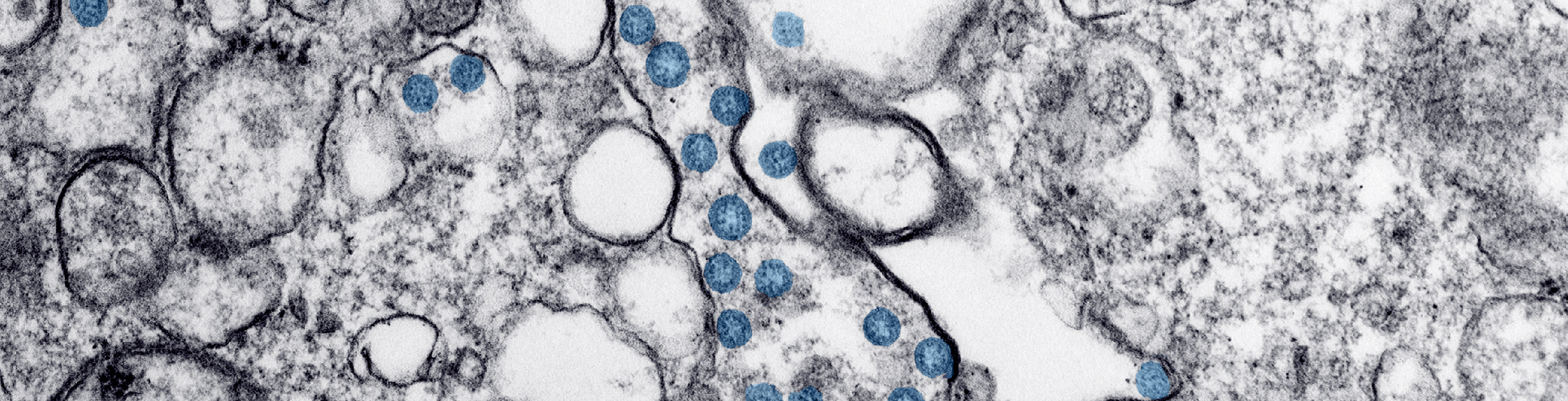 microscopic image of the SARS-CoV19 virus.